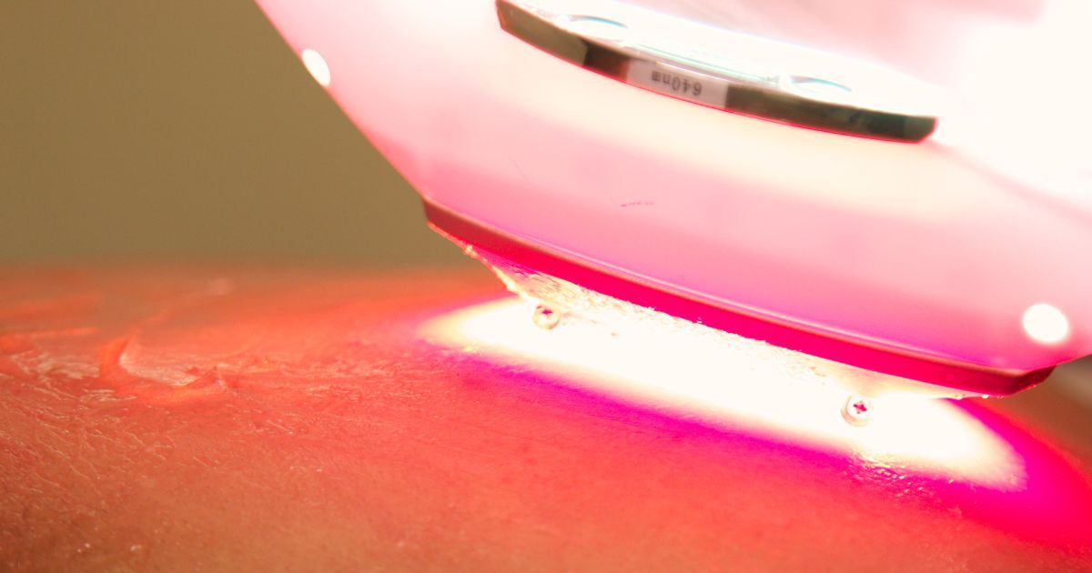 Laser Terapia
