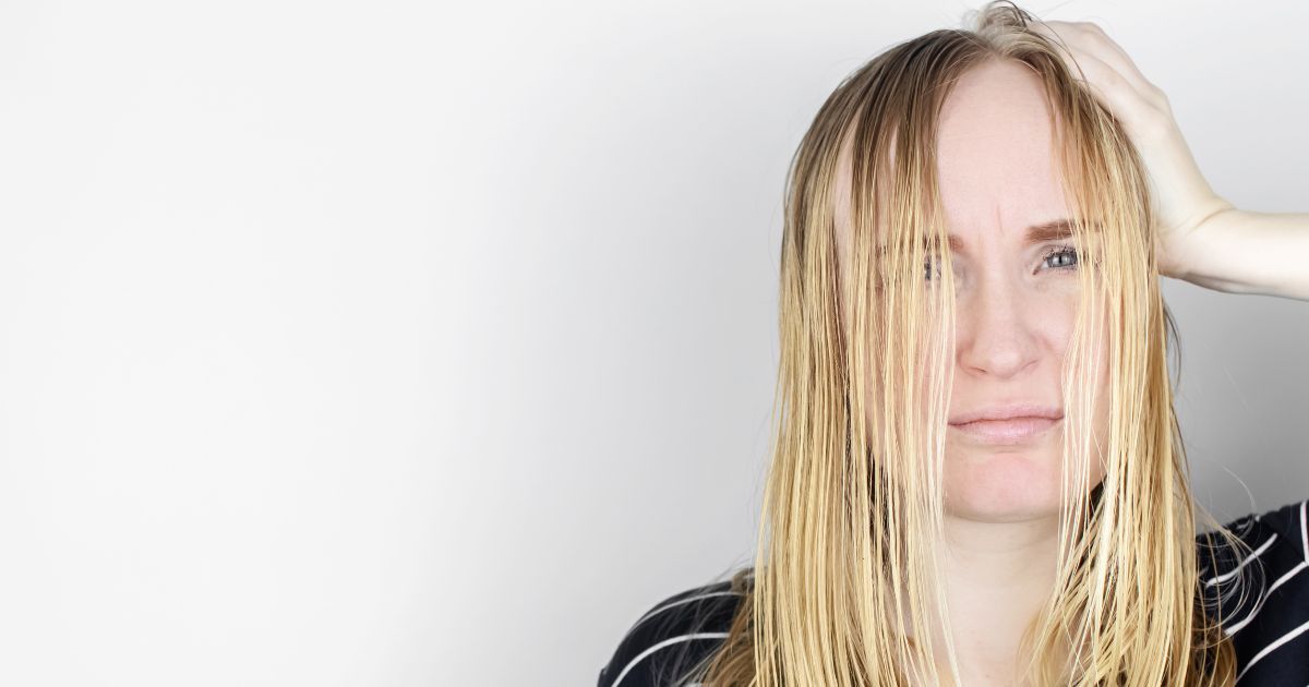 L’alopecia femminile