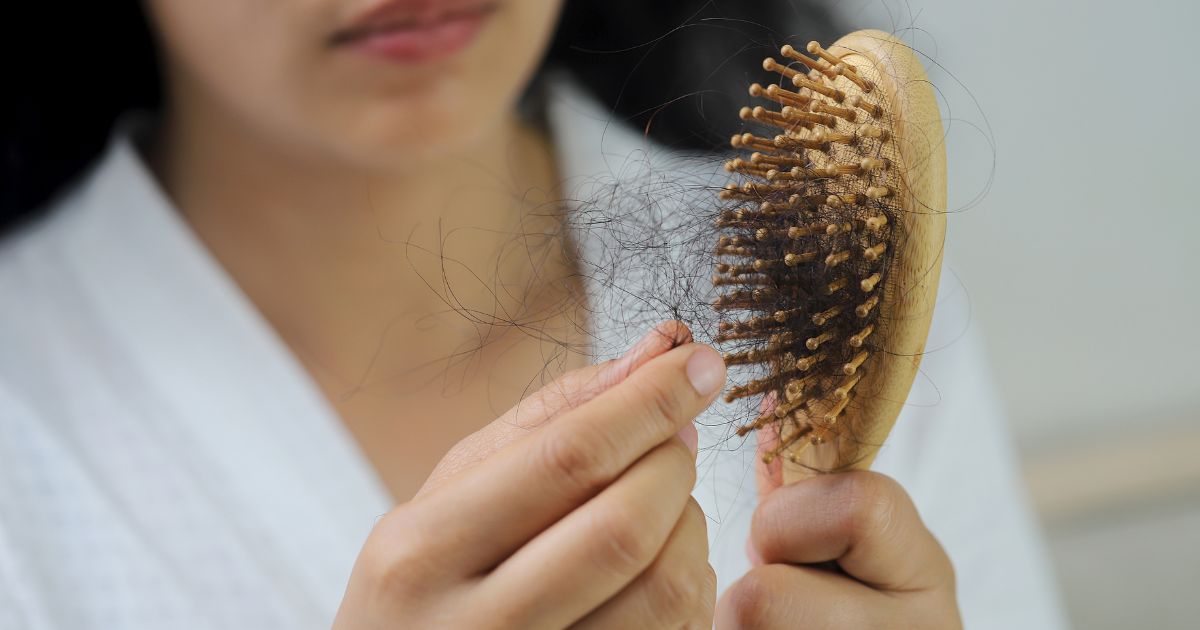 La Caduta dei Capelli Post-Partum